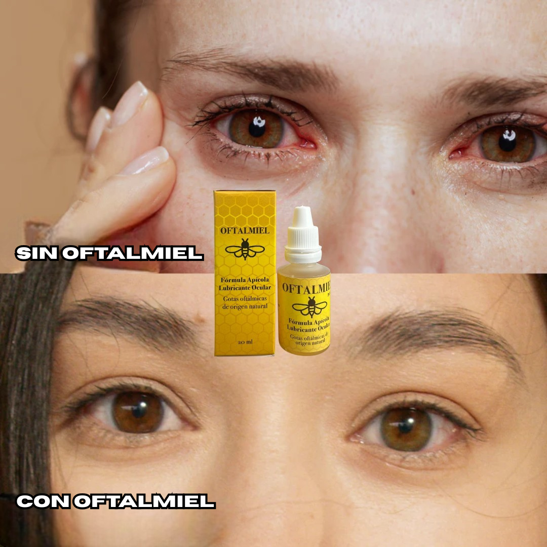 ¡Nuevo! Gotas Oftalmiel  - Alivio Natural para el descanso de tus ojos