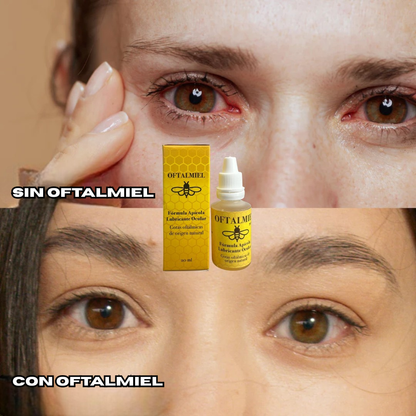 ¡Nuevo! Gotas Oftalmiel  - Alivio Natural para el descanso de tus ojos